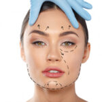 woman with dotted lines face cosmetology